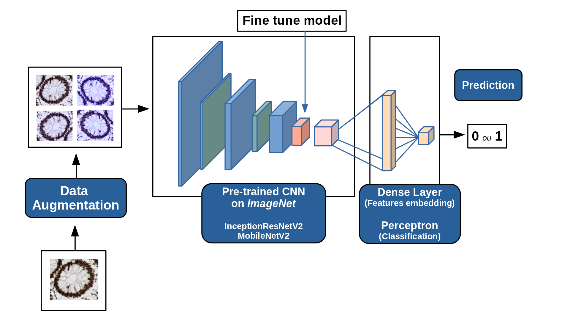 Machine Learning for the detection of Deficient MMR Crypts to aid in the diagnosis of Lynch Disease